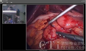 ��ǻ�R���g(sh��)����